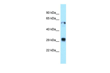TMX1 Rabbit Polyclonal Antibody