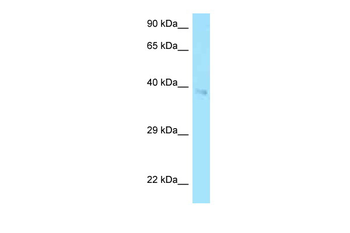 CD2 Rabbit Polyclonal Antibody