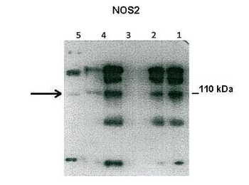 NOS2 Rabbit Polyclonal Antibody