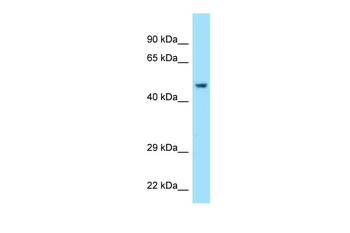 ACR Rabbit Polyclonal Antibody