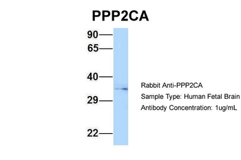 PPP2CA Rabbit Polyclonal Antibody