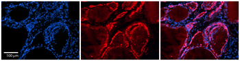 TES Rabbit Polyclonal Antibody