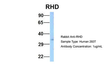 RHD Rabbit Polyclonal Antibody
