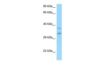 C9orf30 Rabbit Polyclonal Antibody