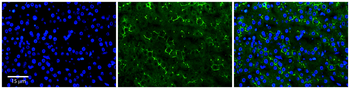 ADCK2 Rabbit Polyclonal Antibody