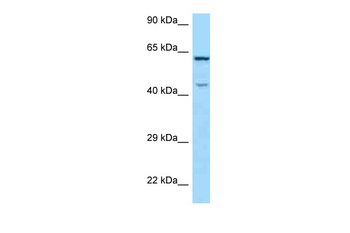 ARMCX5 Rabbit Polyclonal Antibody
