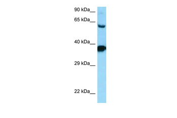 DRD3 Rabbit Polyclonal Antibody