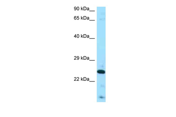 FGF8 Rabbit Polyclonal Antibody