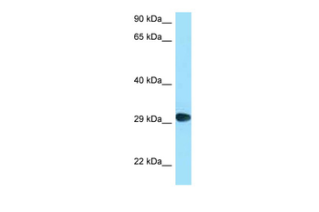 CD58 Rabbit Polyclonal Antibody