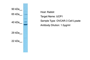 UCP1 Rabbit Polyclonal Antibody