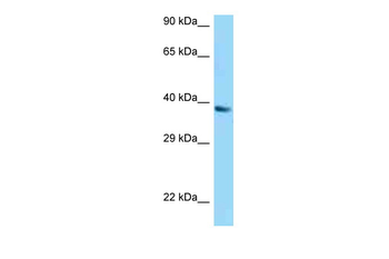 UCP1 Rabbit Polyclonal Antibody