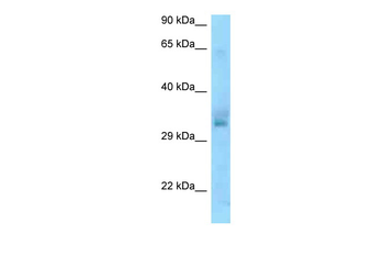 UCP1 Rabbit Polyclonal Antibody
