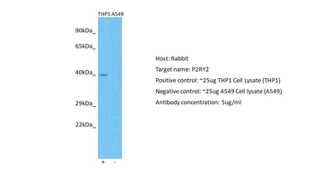 P2RY2 Rabbit Polyclonal Antibody