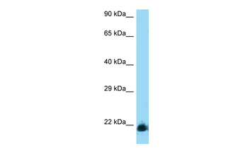 KLRD1 Rabbit Polyclonal Antibody