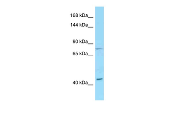 DSG1 Rabbit Polyclonal Antibody