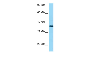 COQ9 Rabbit Polyclonal Antibody