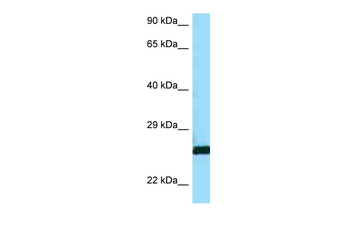 CTSH Rabbit Polyclonal Antibody