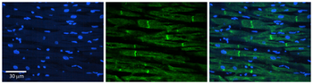 HLA-DMB Rabbit Polyclonal Antibody