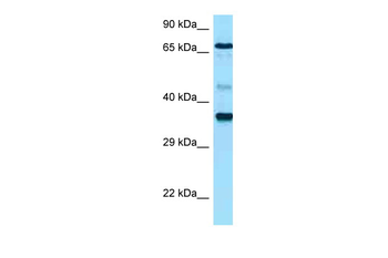 HAS1 Rabbit Polyclonal Antibody