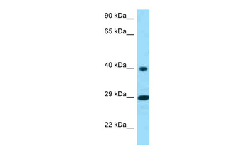 RGR Rabbit Polyclonal Antibody
