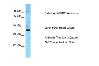 DMC1 Rabbit Polyclonal Antibody