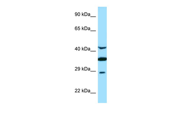 TOR1A Rabbit Polyclonal Antibody