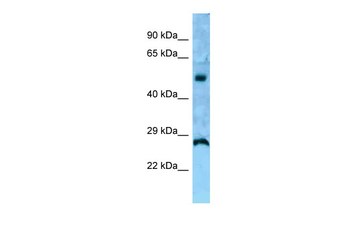 IL13RA1 Rabbit Polyclonal Antibody