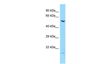 LIPC Rabbit Polyclonal Antibody