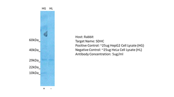 SDHC Rabbit Polyclonal Antibody