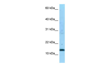 SDHC Rabbit Polyclonal Antibody