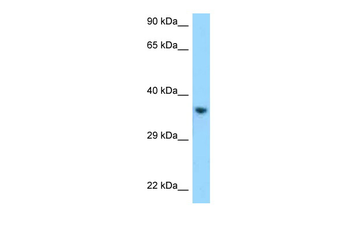 KIR2DL1 Rabbit Polyclonal Antibody