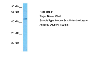 WASL Rabbit Polyclonal Antibody