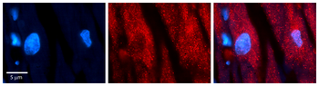 WASL Rabbit Polyclonal Antibody
