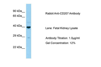 CD207 Rabbit Polyclonal Antibody