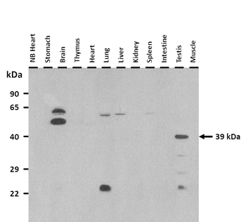 Abi3 Rabbit Polyclonal Antibody