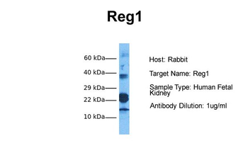 Reg1 Rabbit Polyclonal Antibody