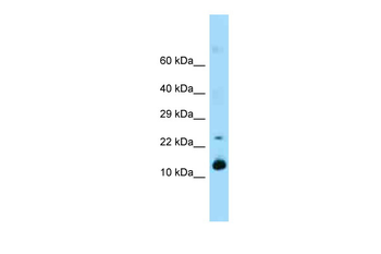 Reg1 Rabbit Polyclonal Antibody