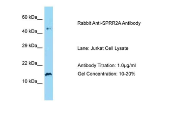 SPRR2A Rabbit Polyclonal Antibody