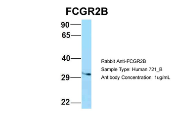 FCGR2B Rabbit Polyclonal Antibody