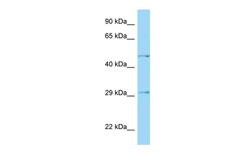 HTRA1 Rabbit Polyclonal Antibody