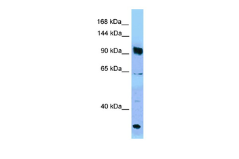 PARG Rabbit Polyclonal Antibody