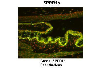 SPRR1B Rabbit Polyclonal Antibody