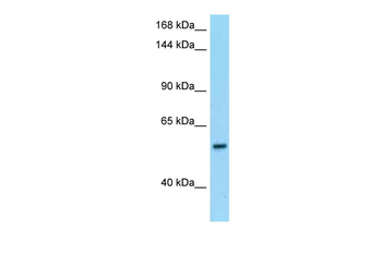 PDE6B Rabbit Polyclonal Antibody