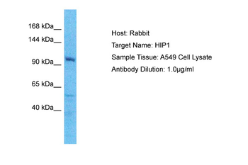 HIP1 Rabbit Polyclonal Antibody