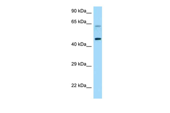 CRHR1 Rabbit Polyclonal Antibody