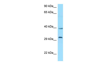 GHSR Rabbit Polyclonal Antibody