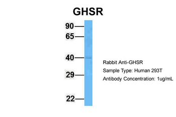 GHSR Rabbit Polyclonal Antibody
