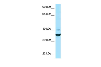 NCR1 Rabbit Polyclonal Antibody