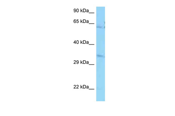 PPCS Rabbit Polyclonal Antibody