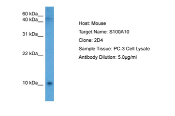 S100A10 Rabbit Polyclonal Antibody